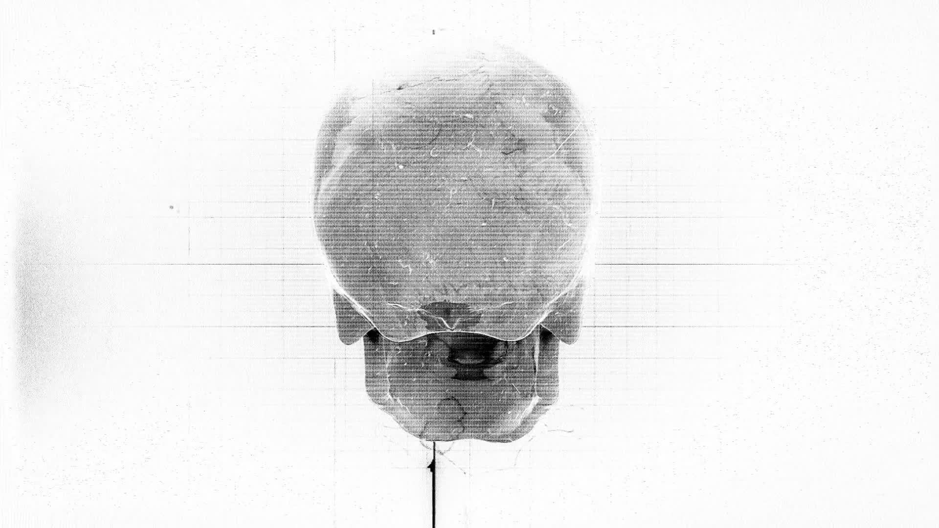 Medical Chart Skull