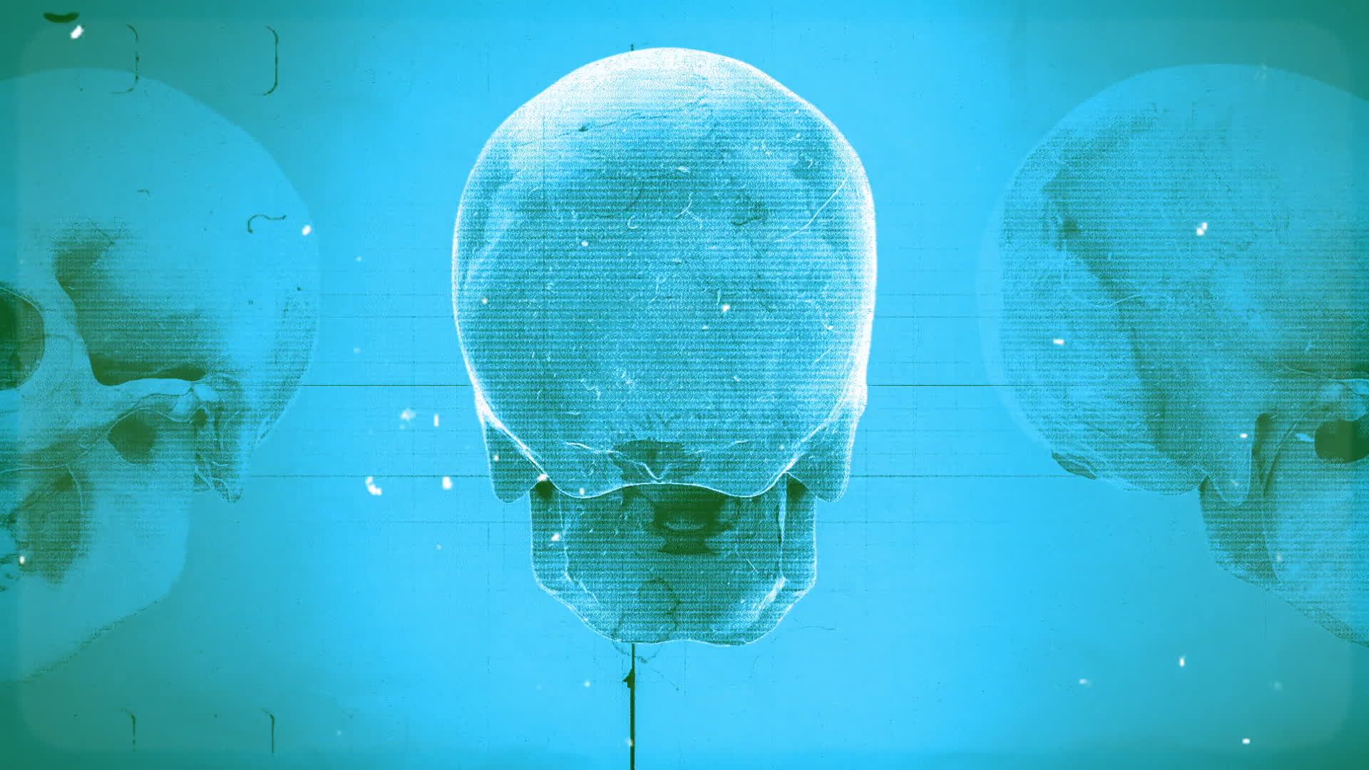 Medical Chart Skull Blue