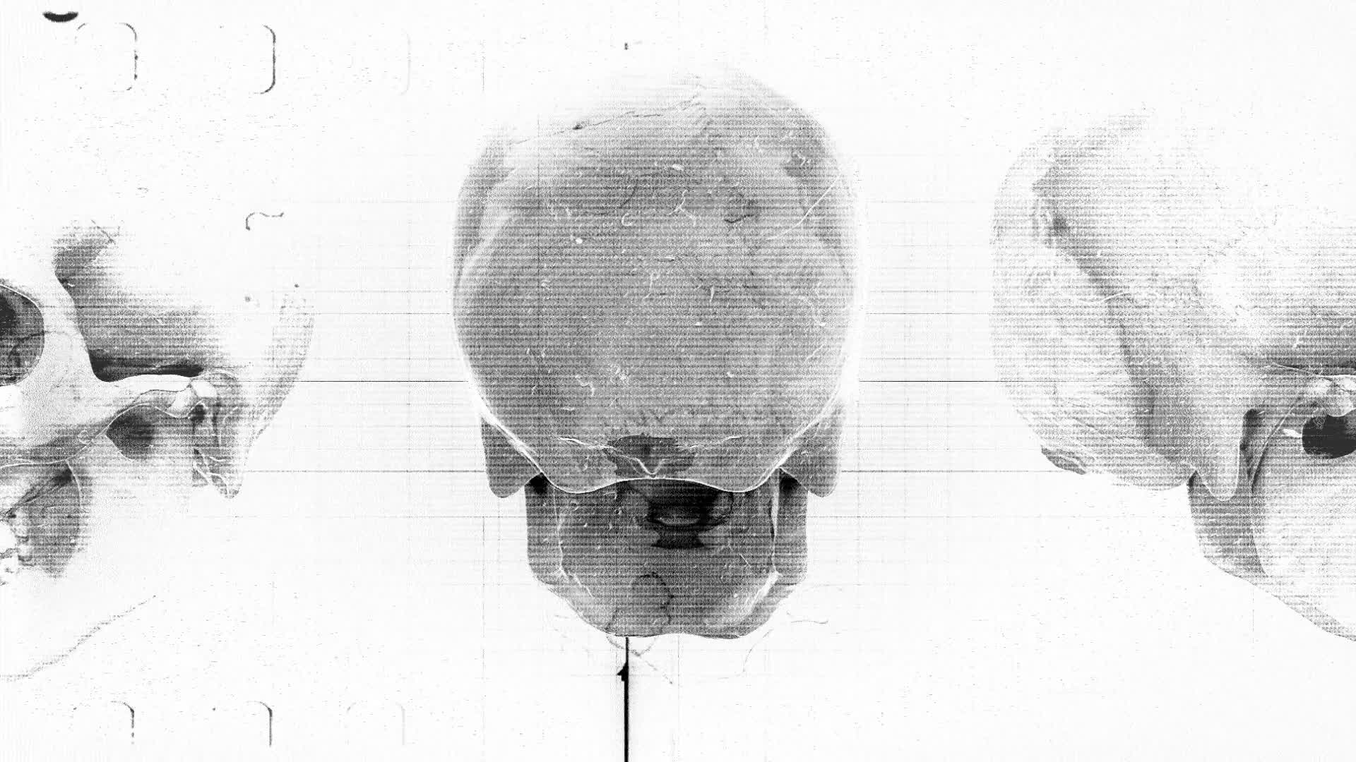 Medical Chart Skulls