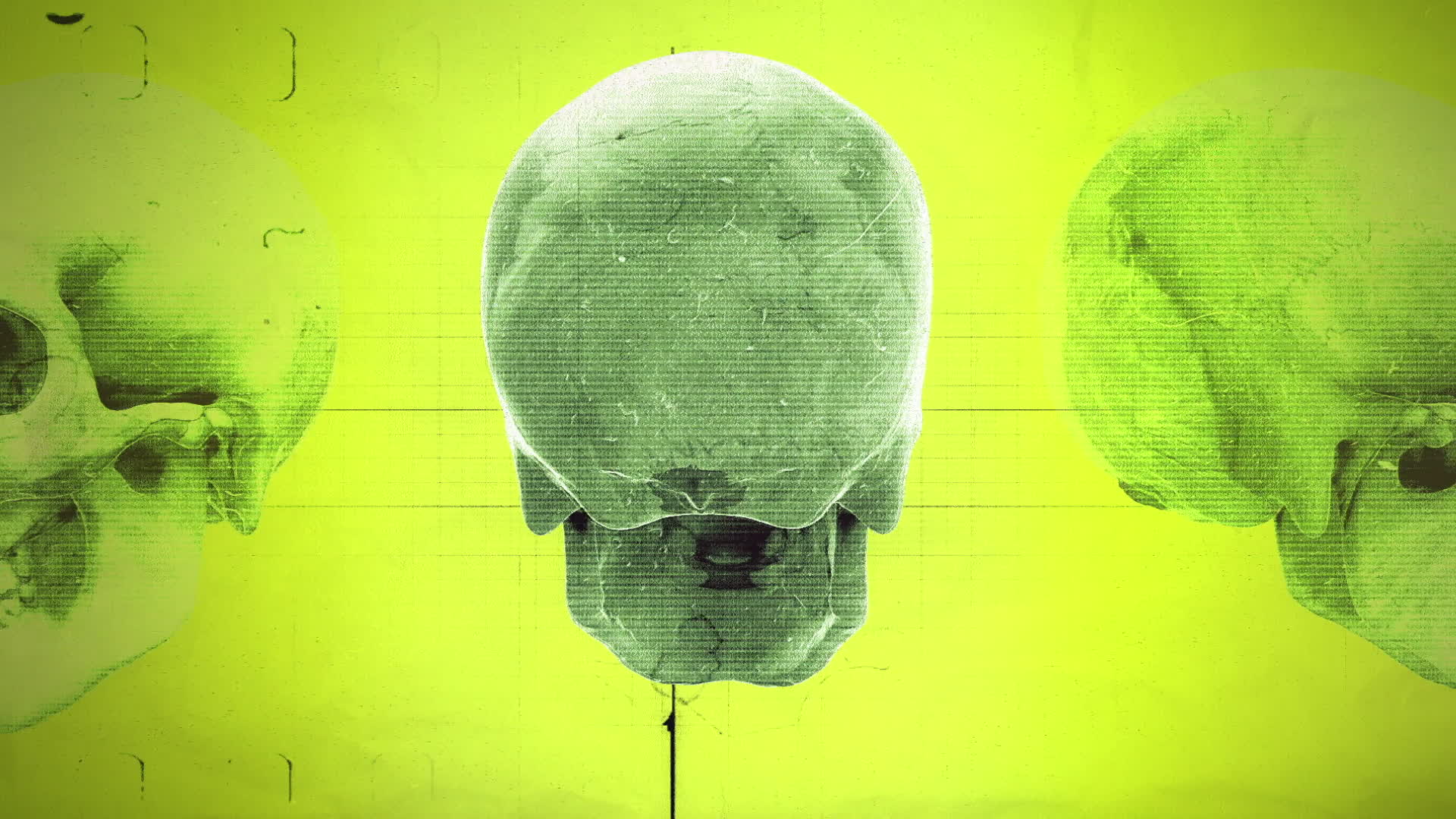 Medical Chart Skulls Yellow