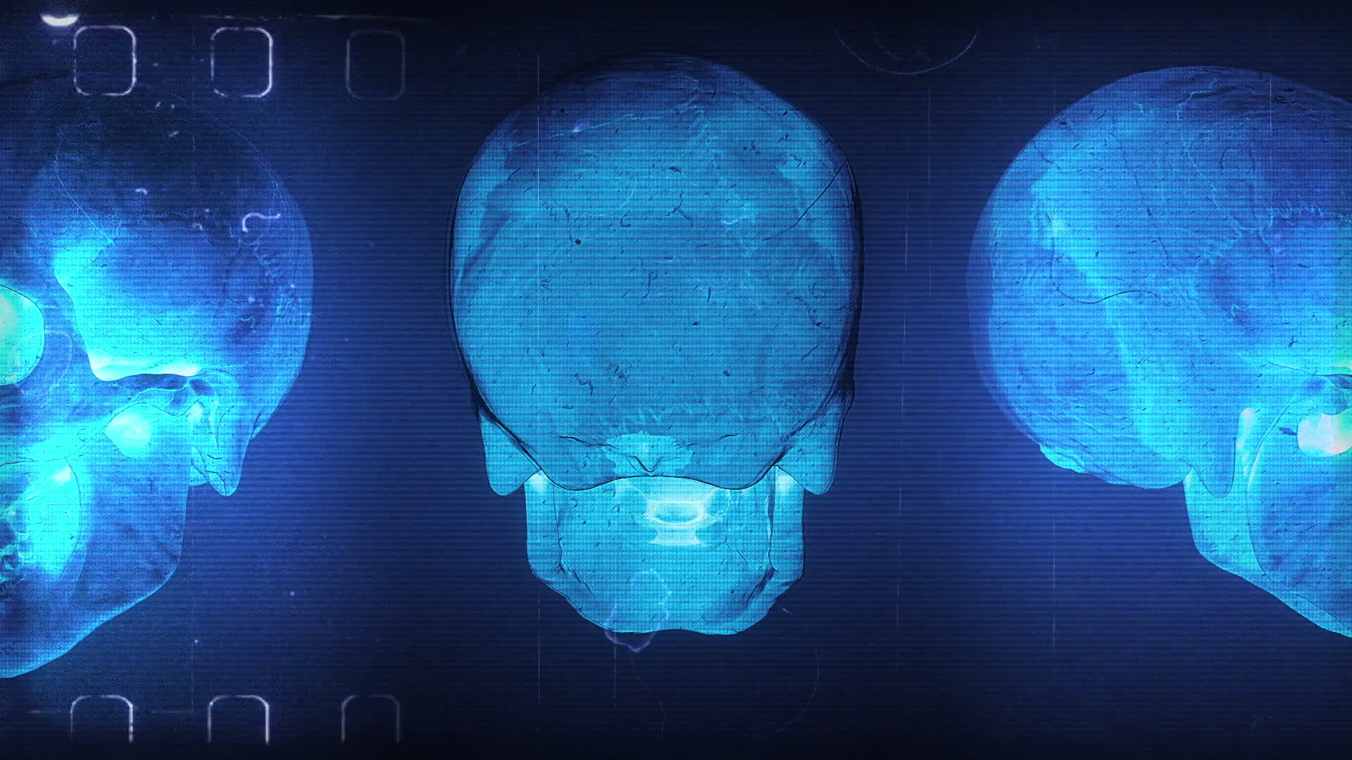 Skulls X-Ray