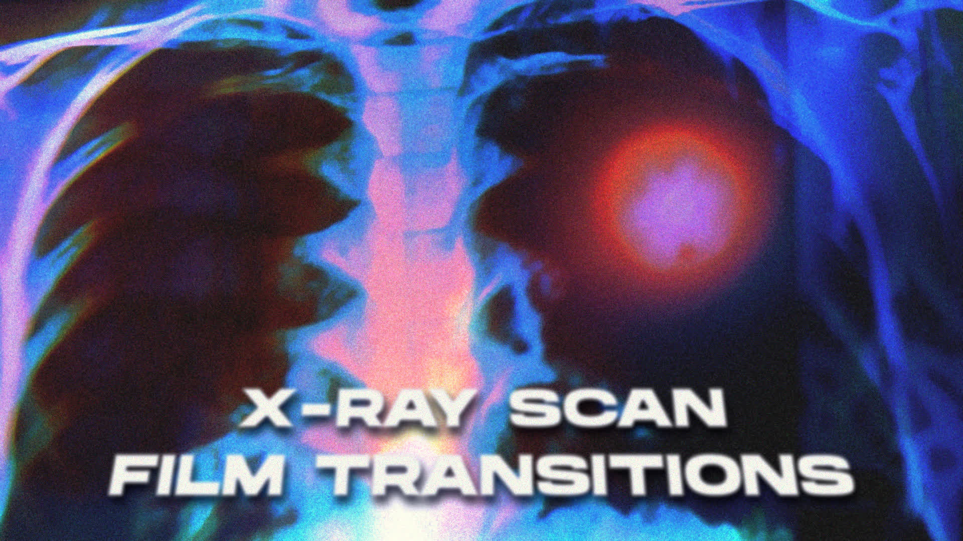 X-ray Scan Film Transitions