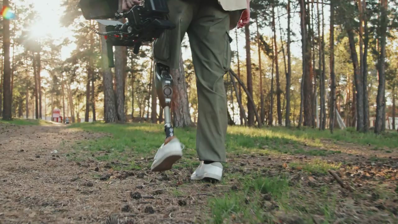 Man with Prosthetic Leg Walking with Camera