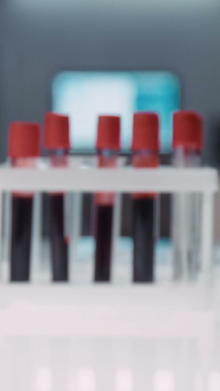Blood Samples in Laboratory Test Tubes