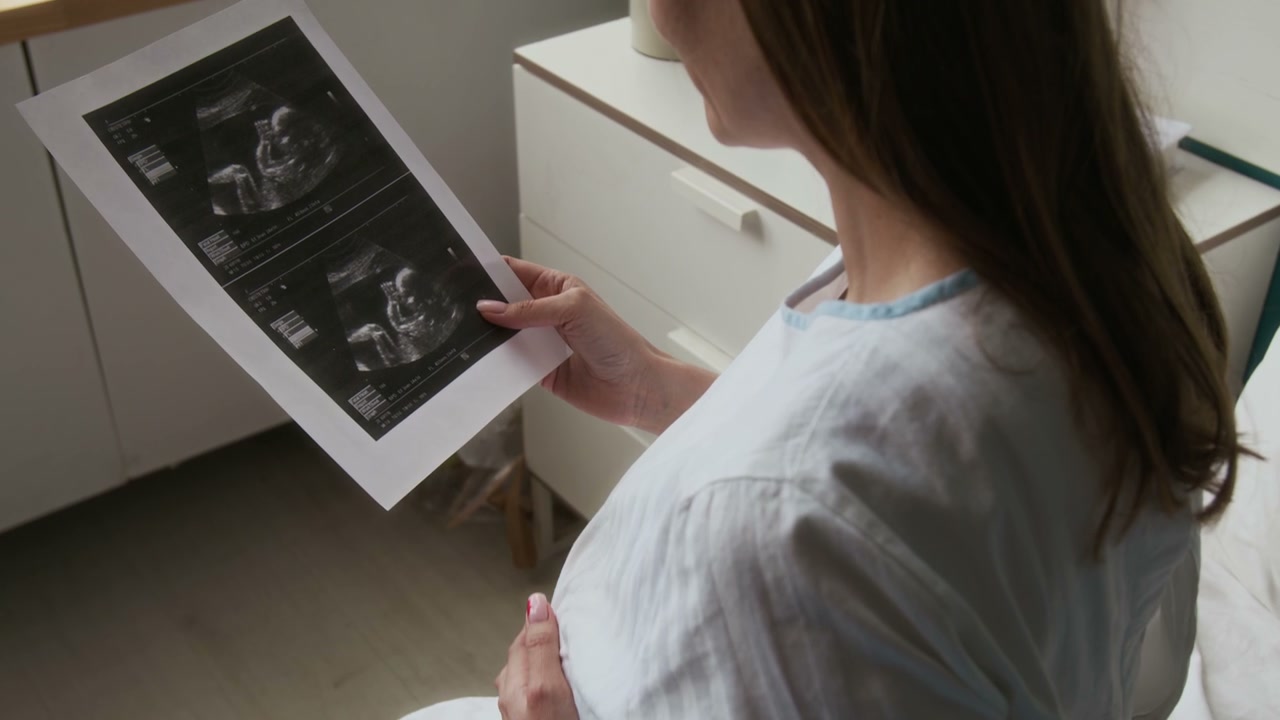 Pregnant Woman Looking at Ultrasound Scan
