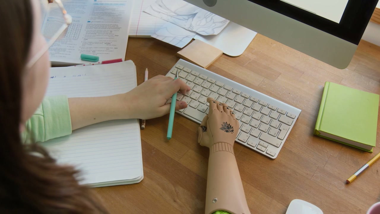 Student with Prosthetic Arm Typing at Desk
