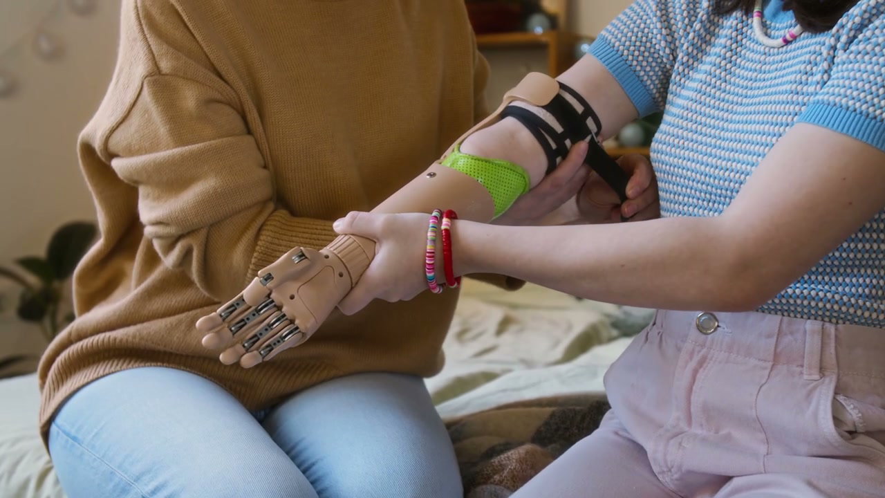 Mother Helps Daughter With Prosthetic Arm