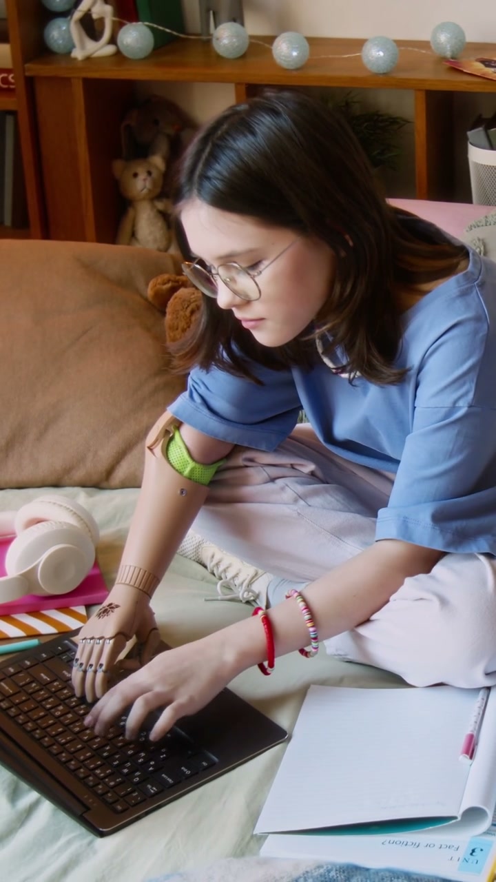 Young Woman with Prosthetic Arm Studies on Bed