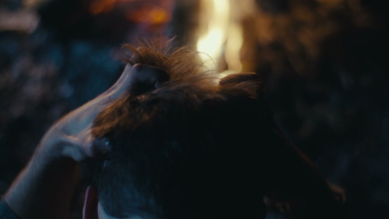 Distressed Person Pulling Hair Near Fire